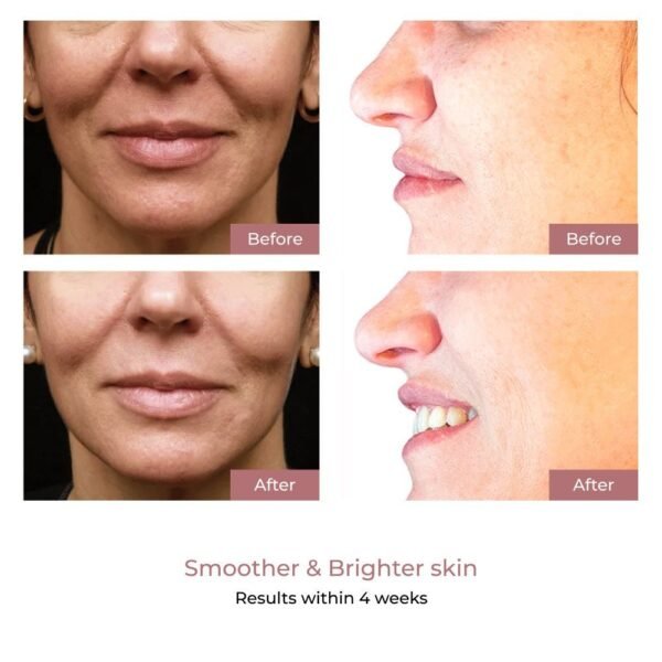 Aura Plus Light Therapy Mask by ARAL Beauty - Image 5